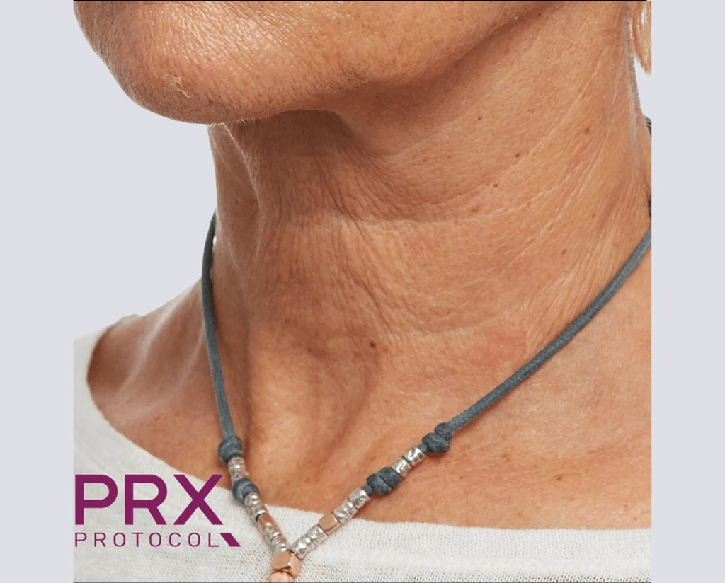 After 10 Treatments