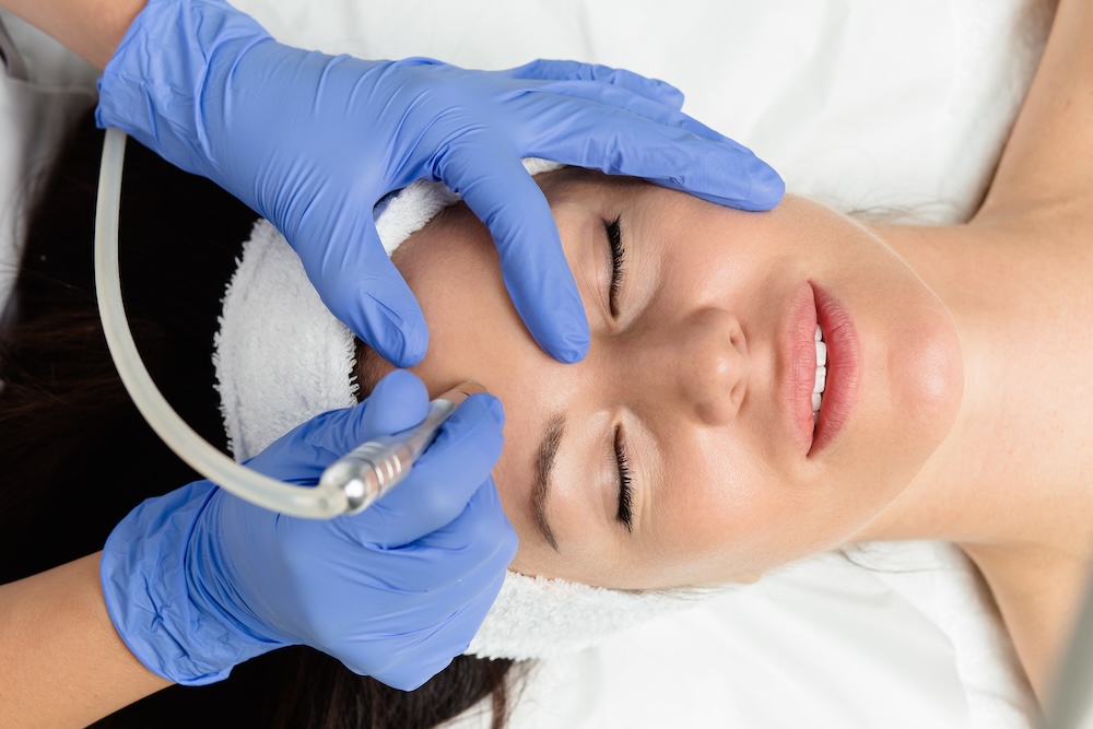 Microdermabrasion-at-Skin-Space-in-Massapequa
